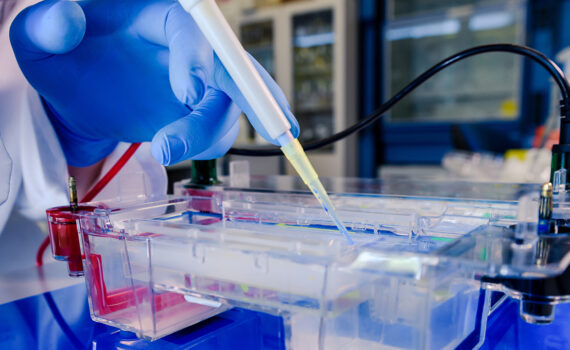 Cientista conduzindo o processo biológico de eletroforese.