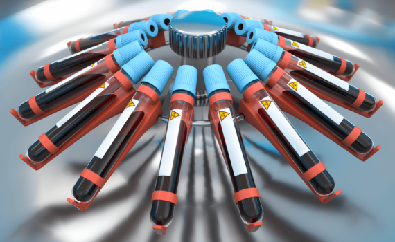 Centrifuga em funcionamento com amostras de sangue.