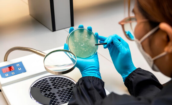 Close up cientista analisando bactérias e bolores em frente ao contador de colonias